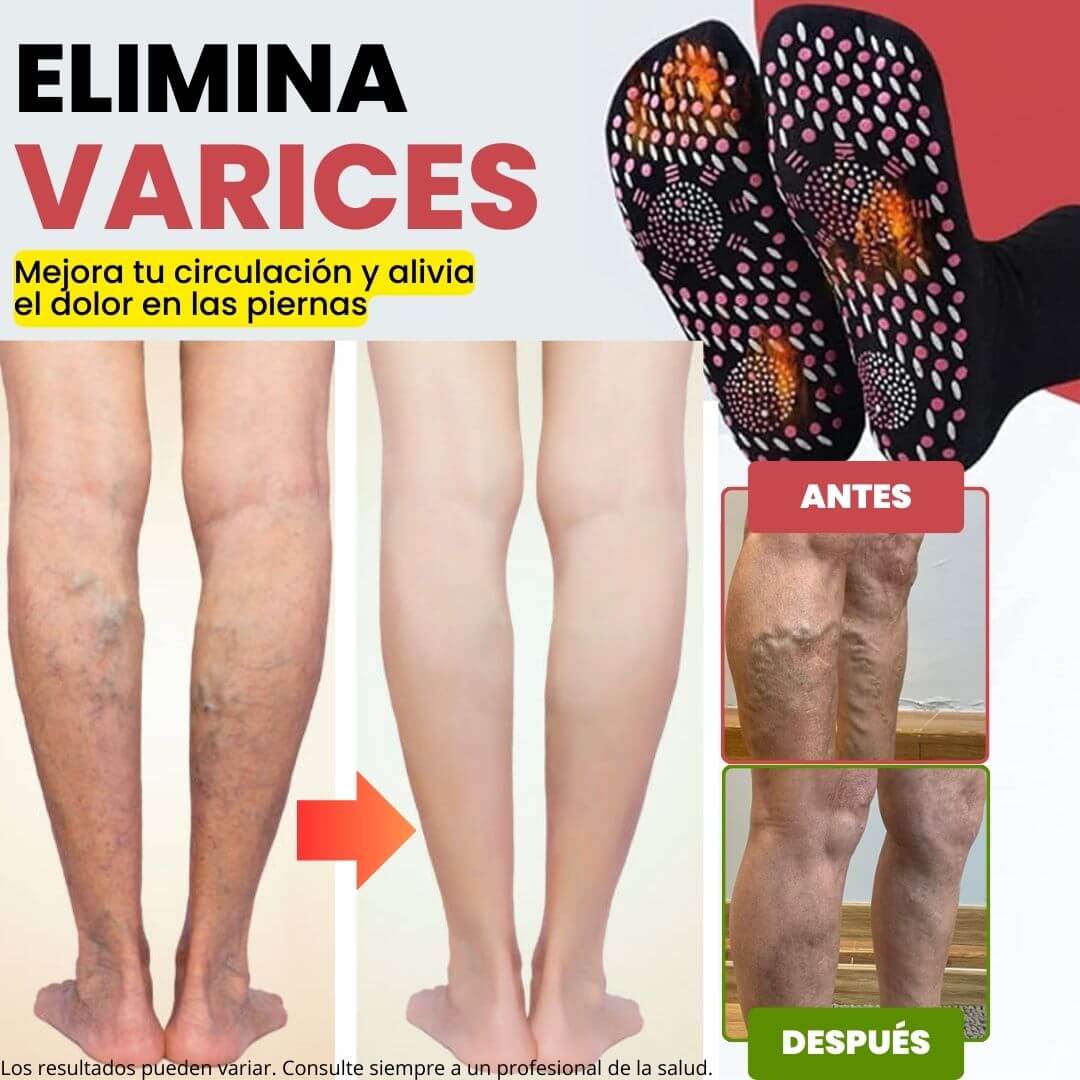 Calcetines de acupresión Anti-Varices