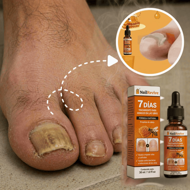 Aceite anti-hongos uñas