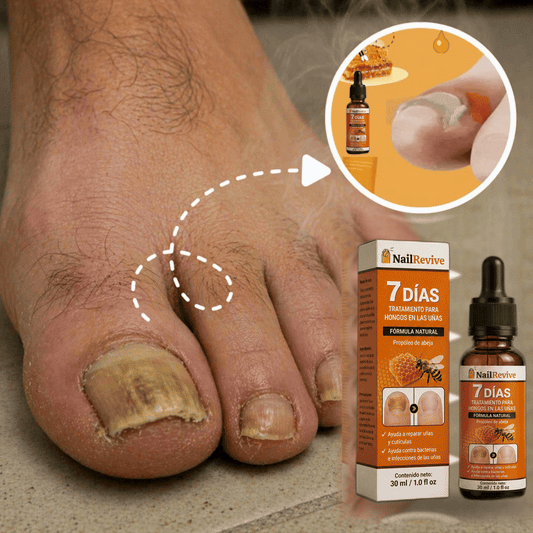 Aceite anti-hongos uñas